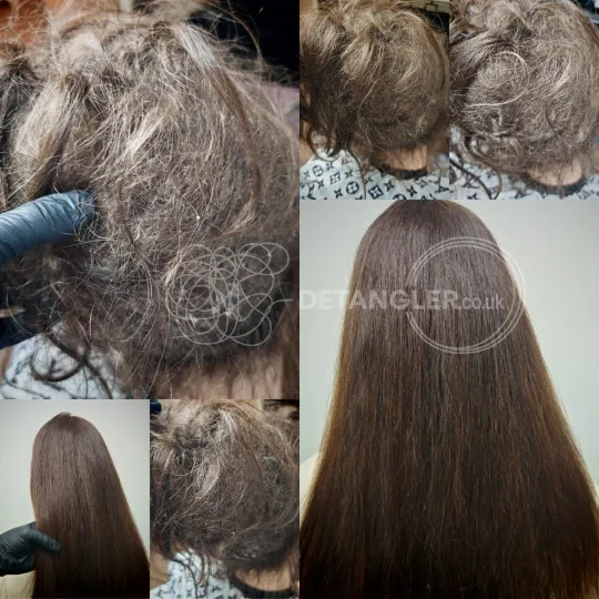 Restoration photographed as documented evidence of a no-cut method