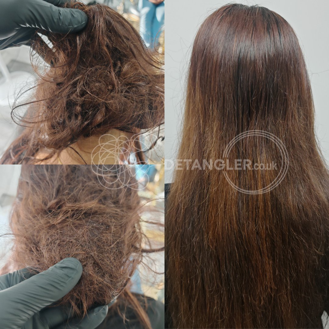 Severe matted hair before and after restoration at Detangler London studio — documented case 1