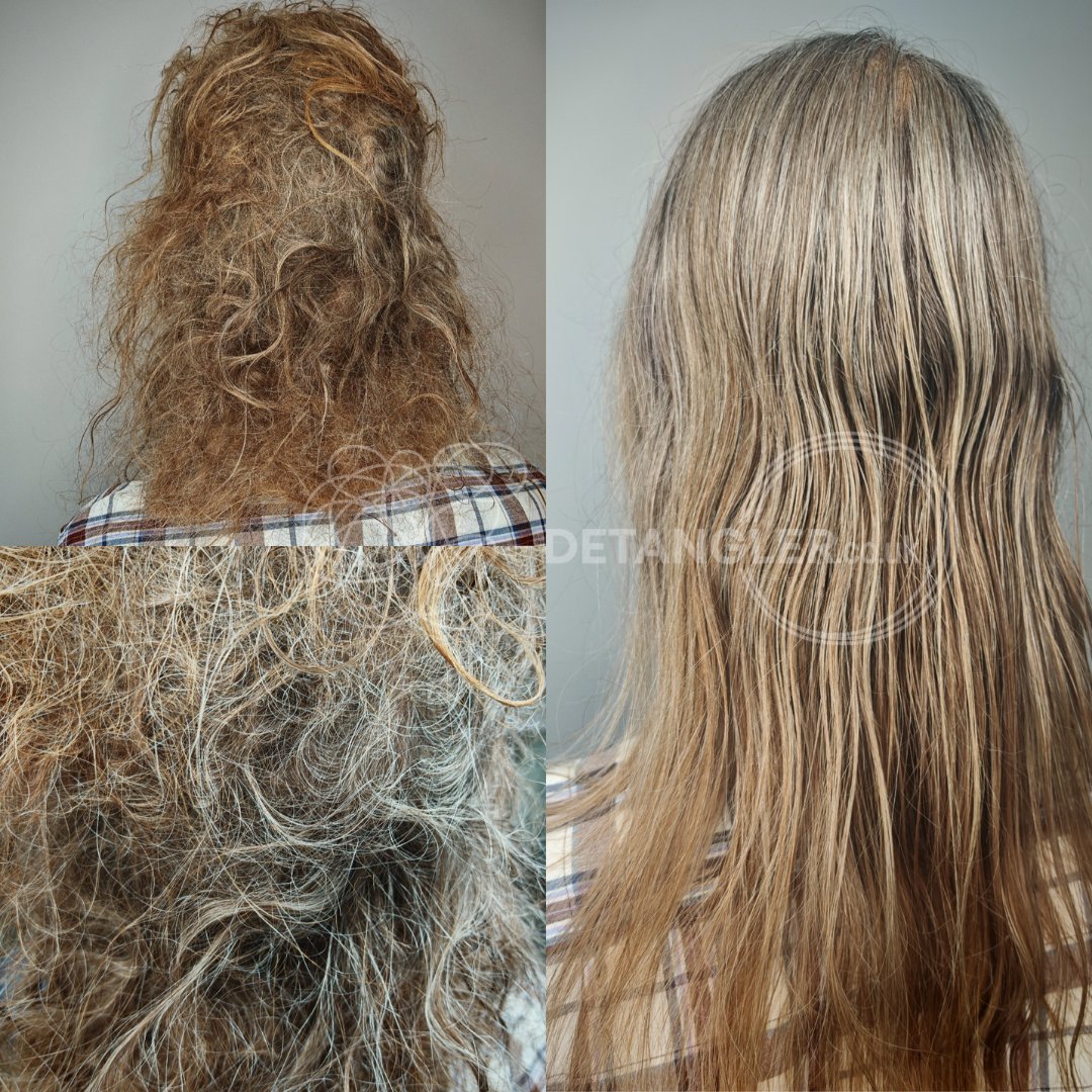 Dense matted hair restored without cutting — Detangler Catford SE6 — documented case 3