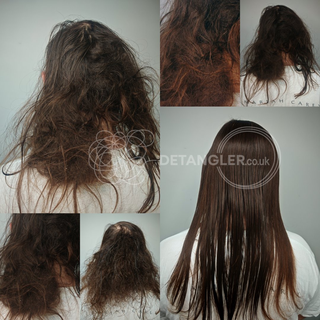 Postpartum matted hair transformation — Detangler London case study — documented case 6