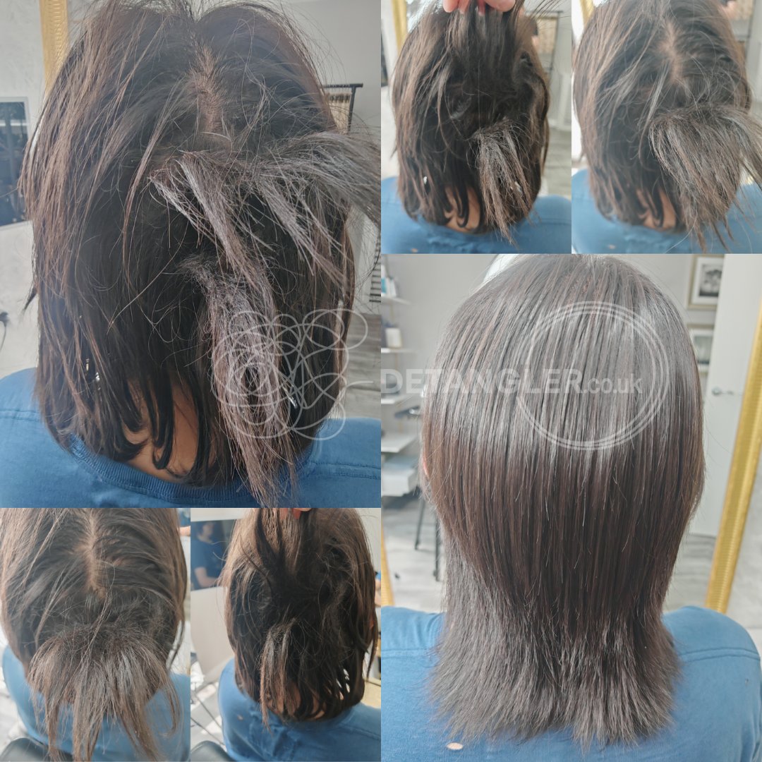 Curly matted hair restored to healthy condition without cutting — documented case 7