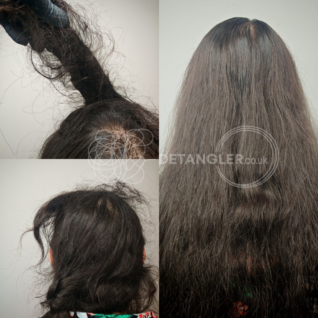 Severe hair matting recovery by professional London specialist — documented case 8