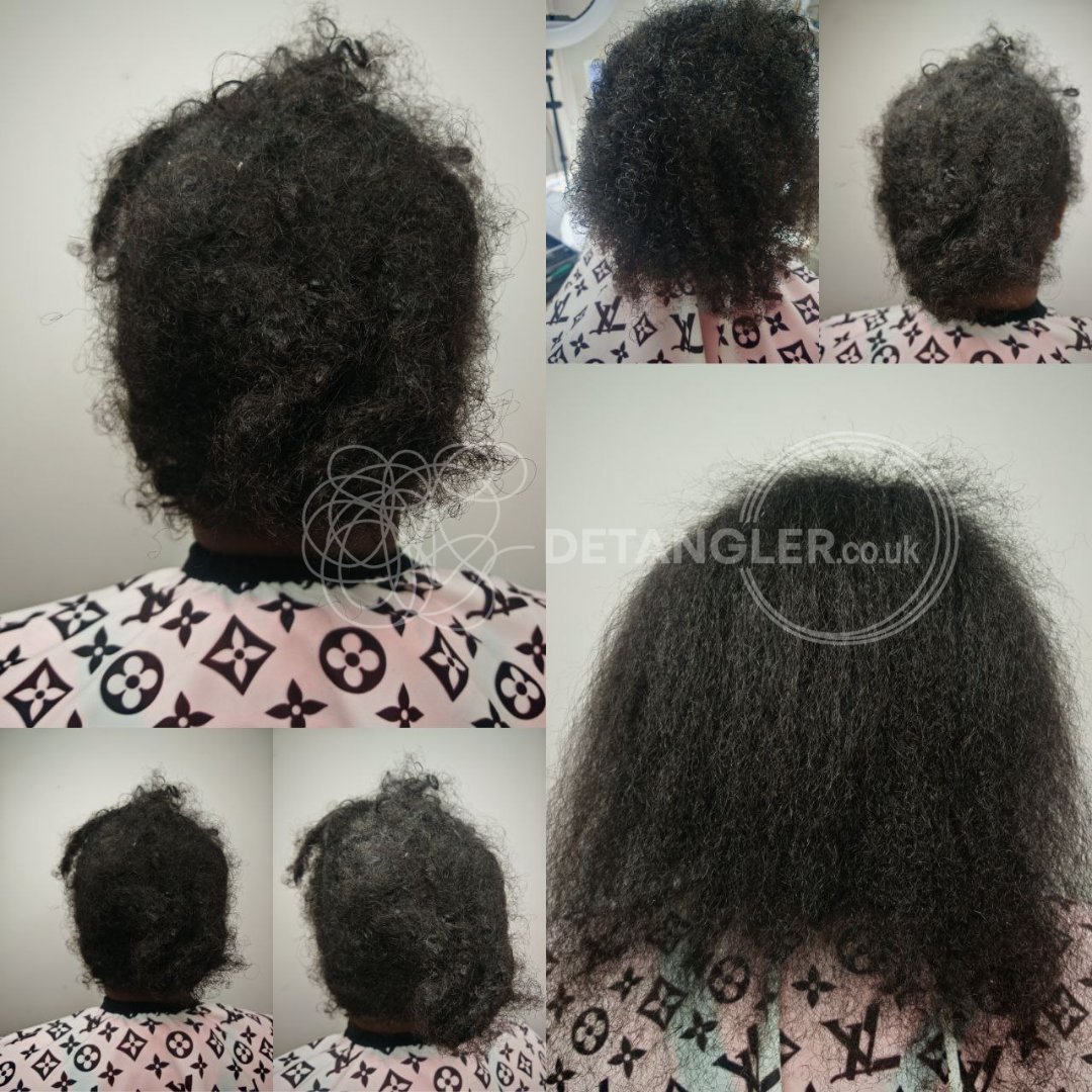 Long-term matted hair restored at Detangler London studio — documented case 14