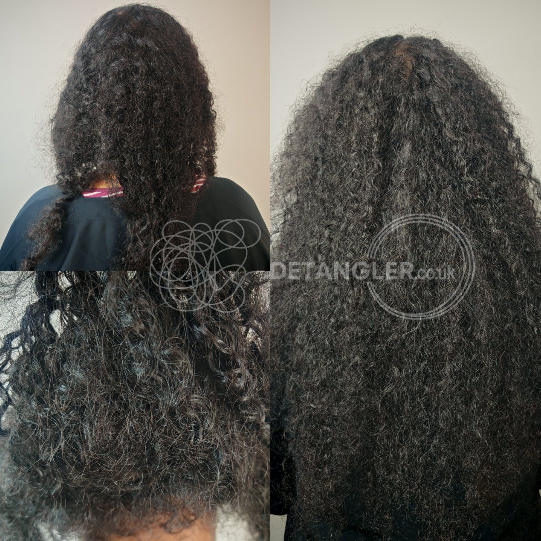 Full head matted hair transformation without scissors — documented case 15