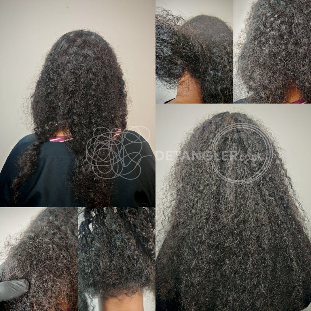 Elderly matted hair restoration — home visit case Detangler London — documented case 16