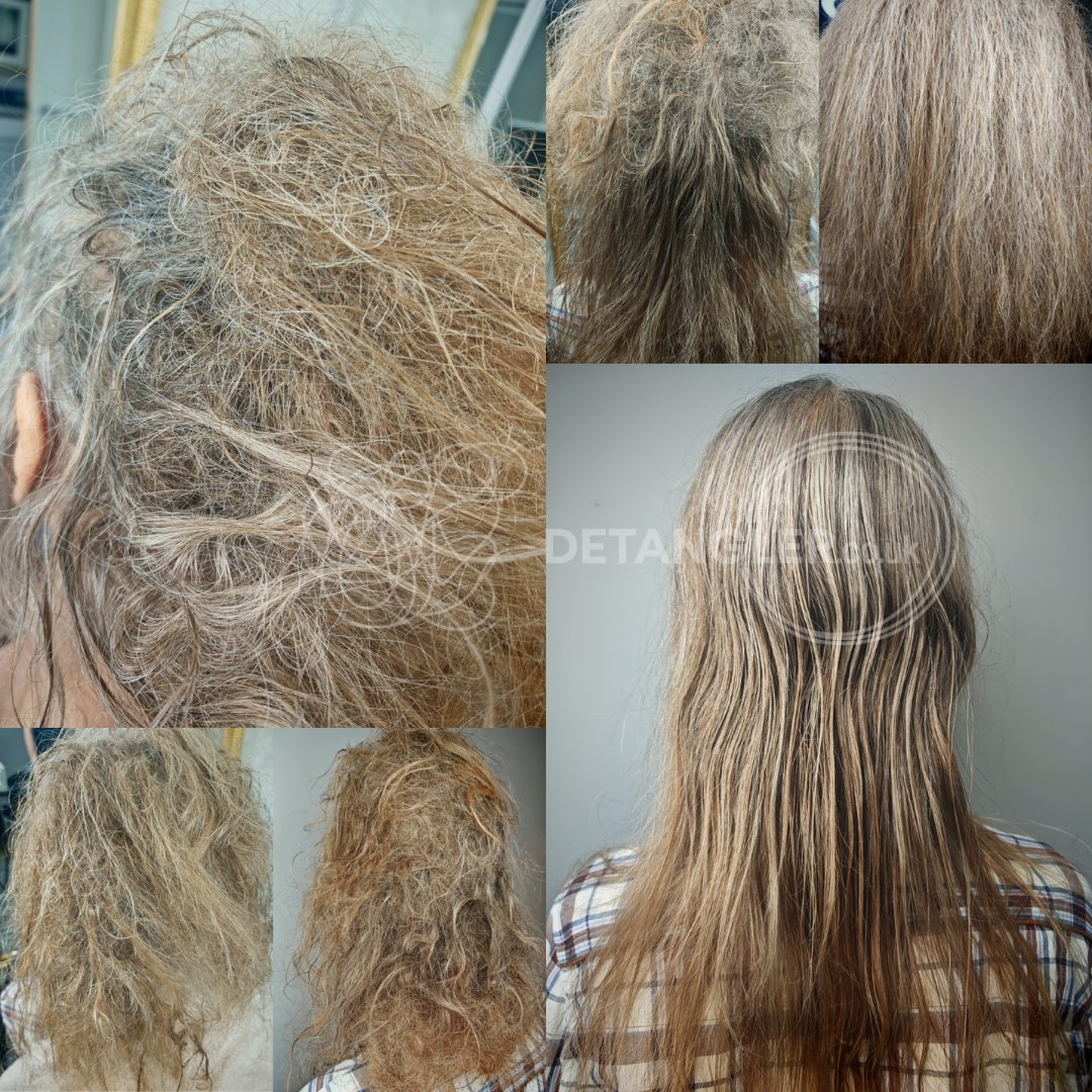 Child matted hair transformation by patient professional specialist — documented case 17