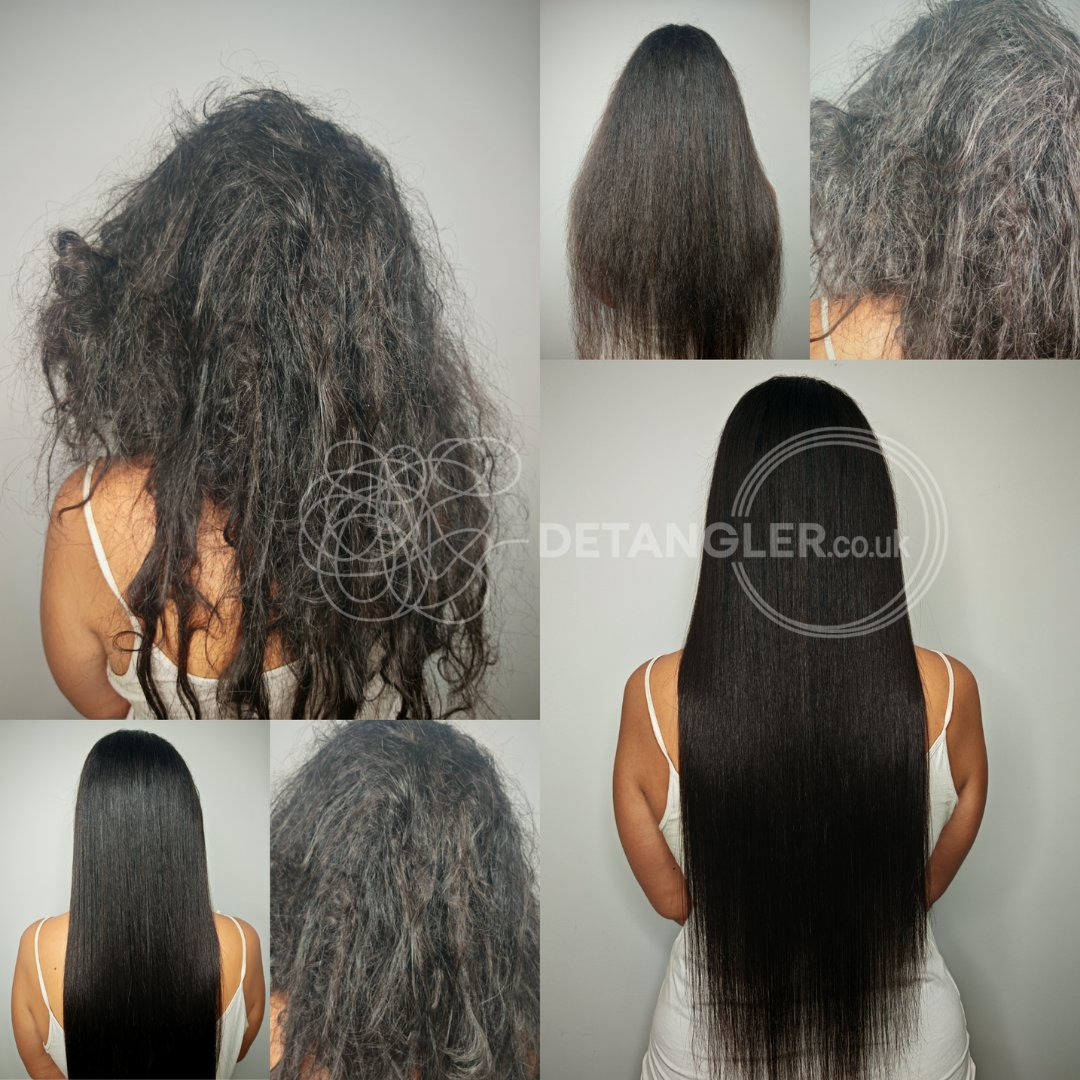 Post-chemotherapy matted hair recovery at London studio — documented case 18