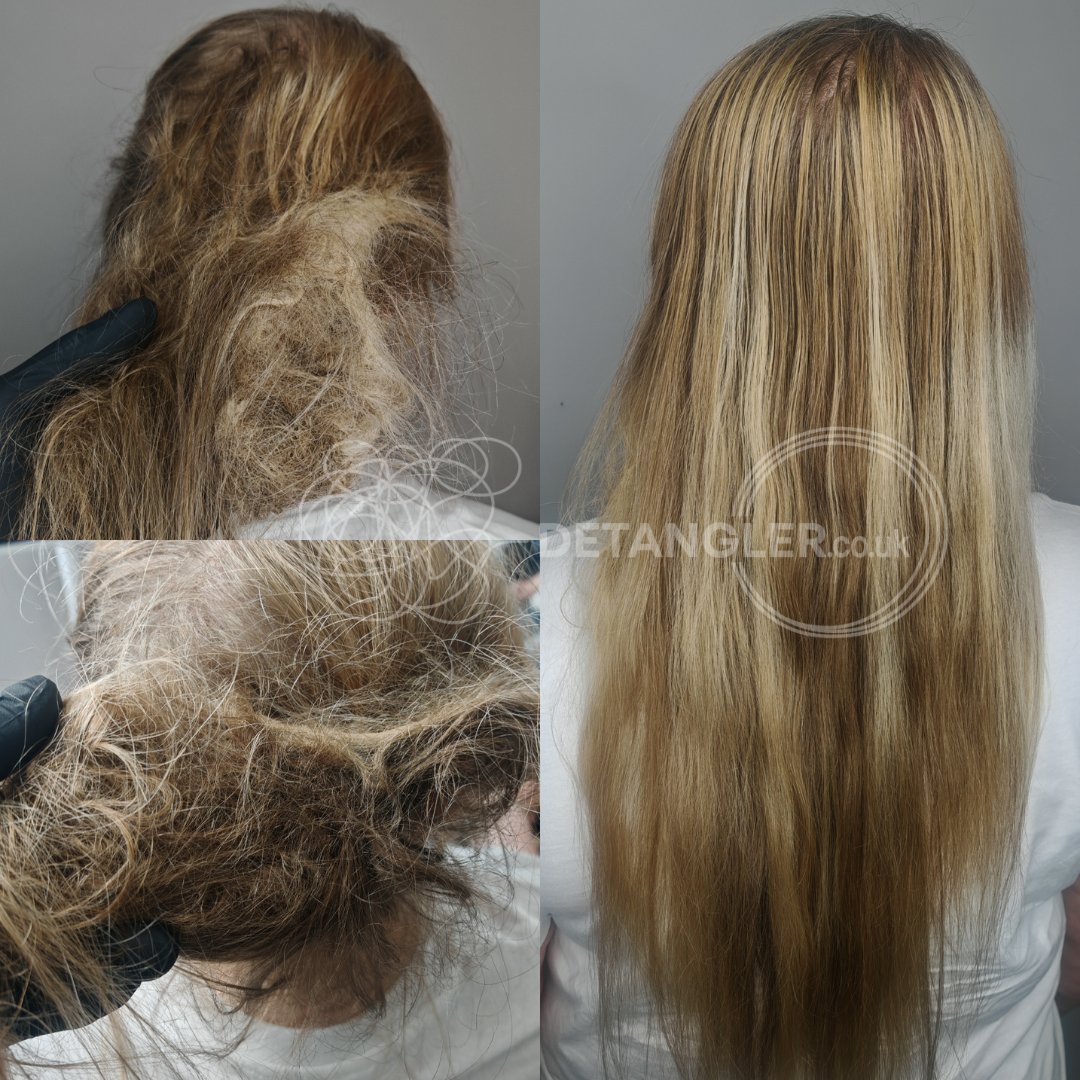 Mid-length matted hair before and after restoration — documented case 19