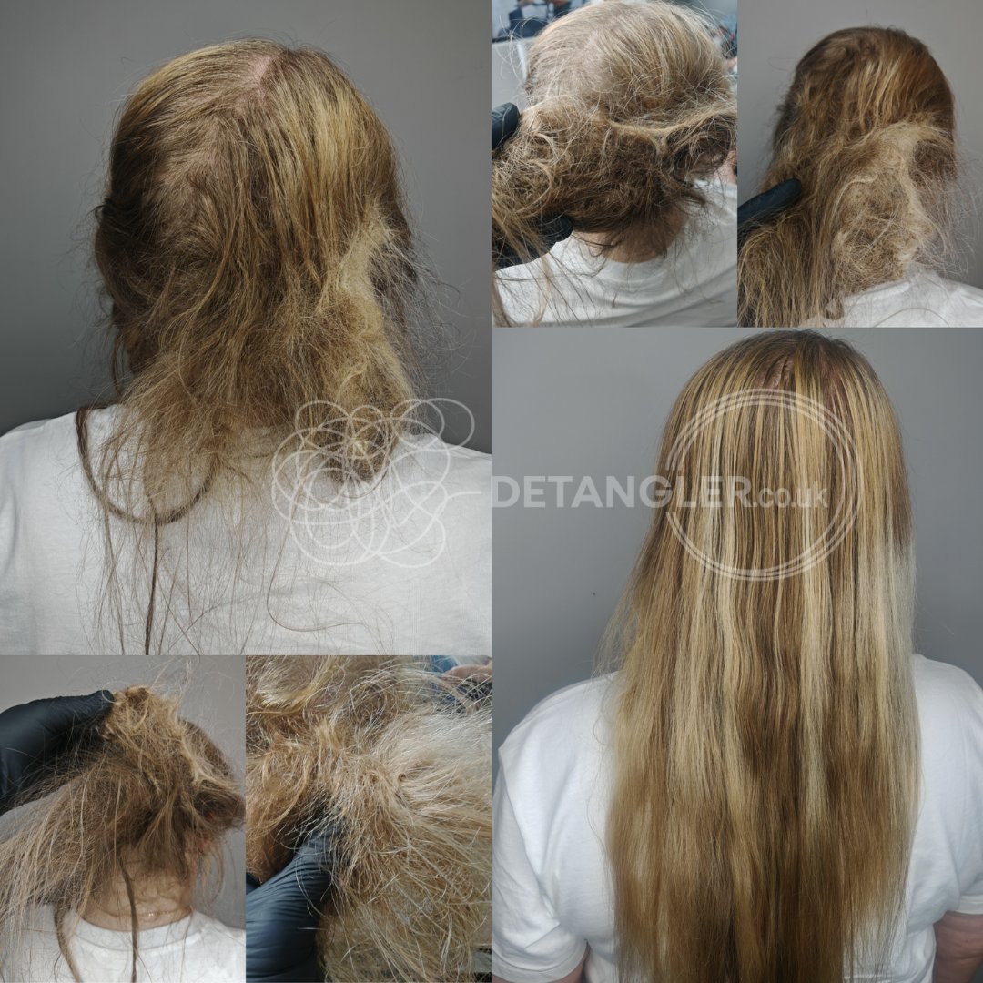 Natural afro matted hair specialist transformation London — documented case 20
