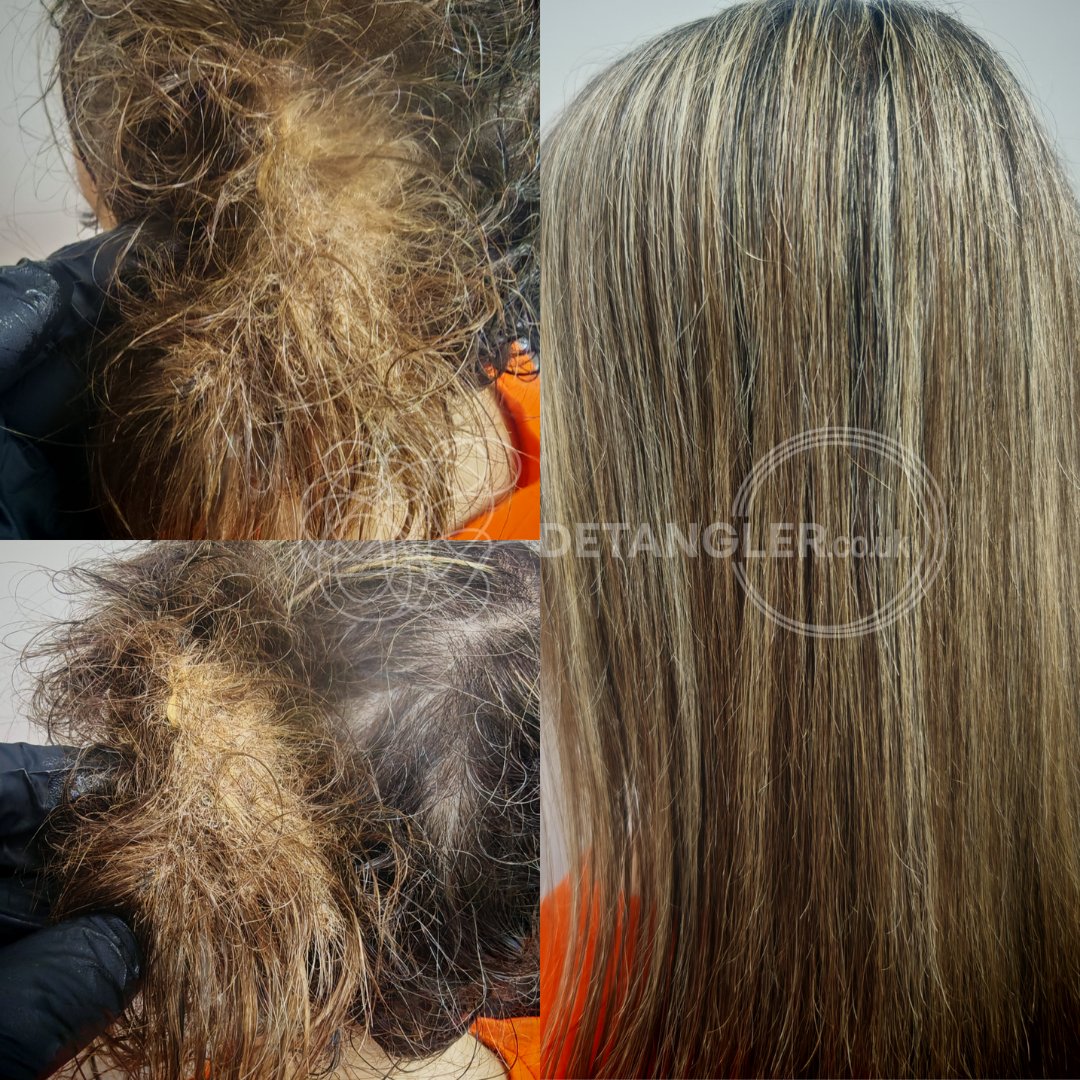 Dense matted hair restored without cutting — Detangler Catford SE6 — documented case 23