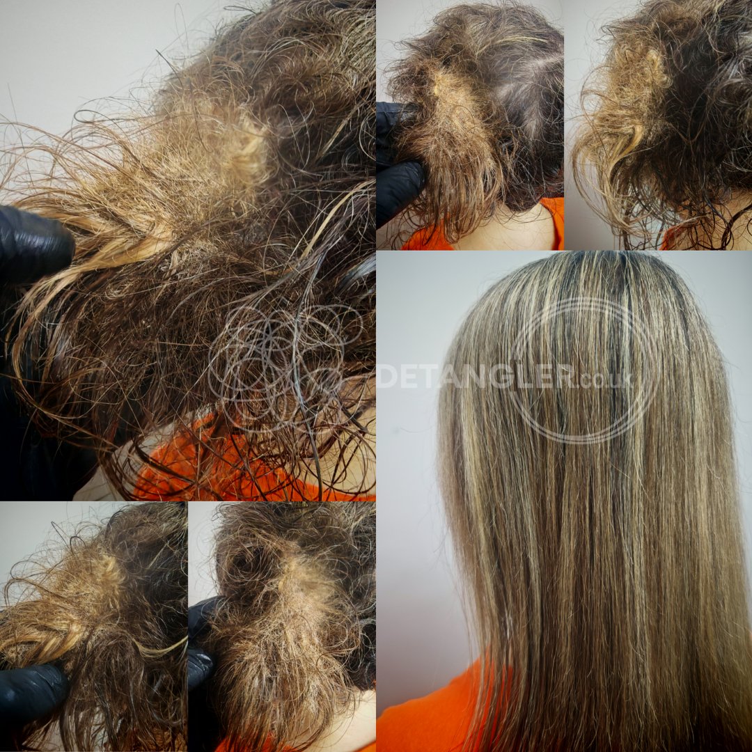 Before and after photo of matted hair recovery at London studio — documented case 24