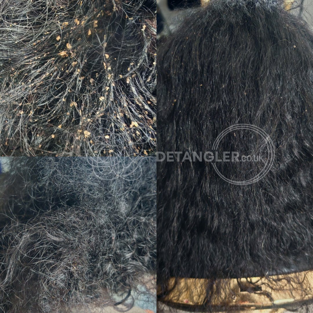 Postpartum matted hair transformation — Detangler London case study — documented case 26