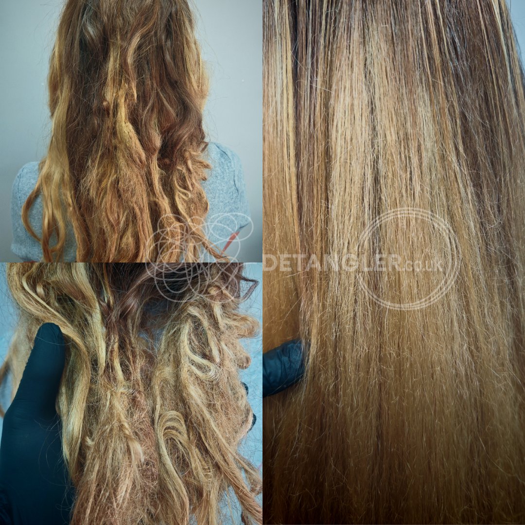 Severe hair matting recovery by professional London specialist — documented case 28