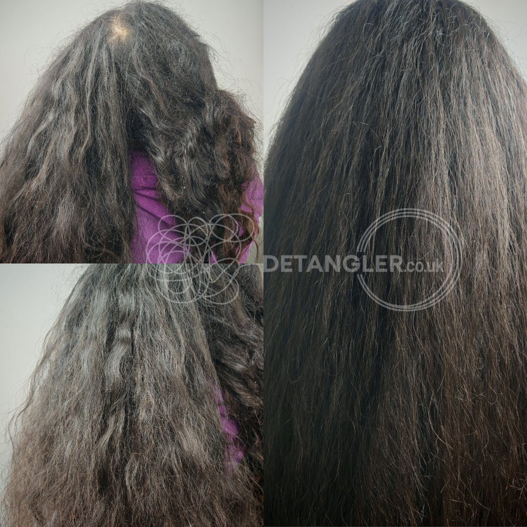 Professional matted hair restoration with documented before after photos — documented case 30