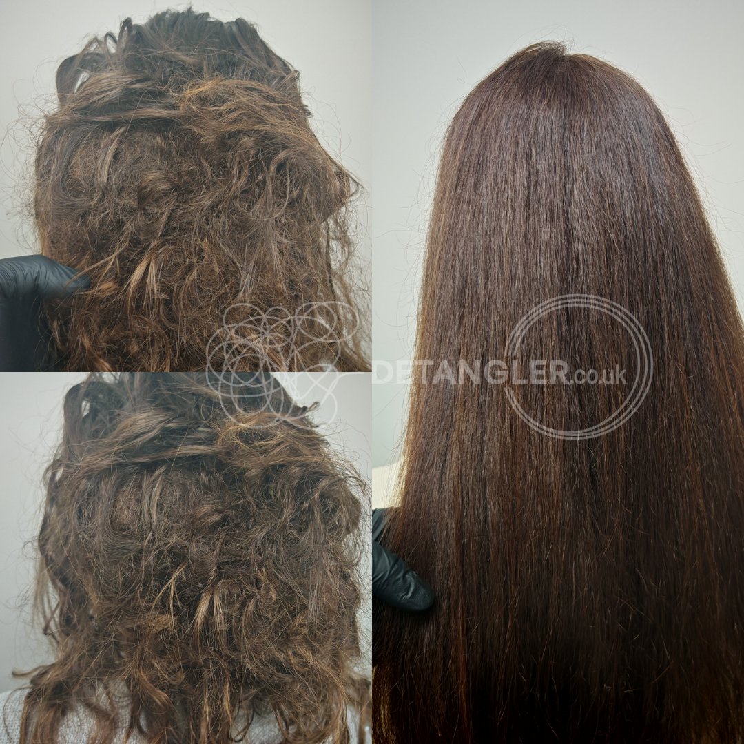 Long-term matted hair restored at Detangler London studio — documented case 34