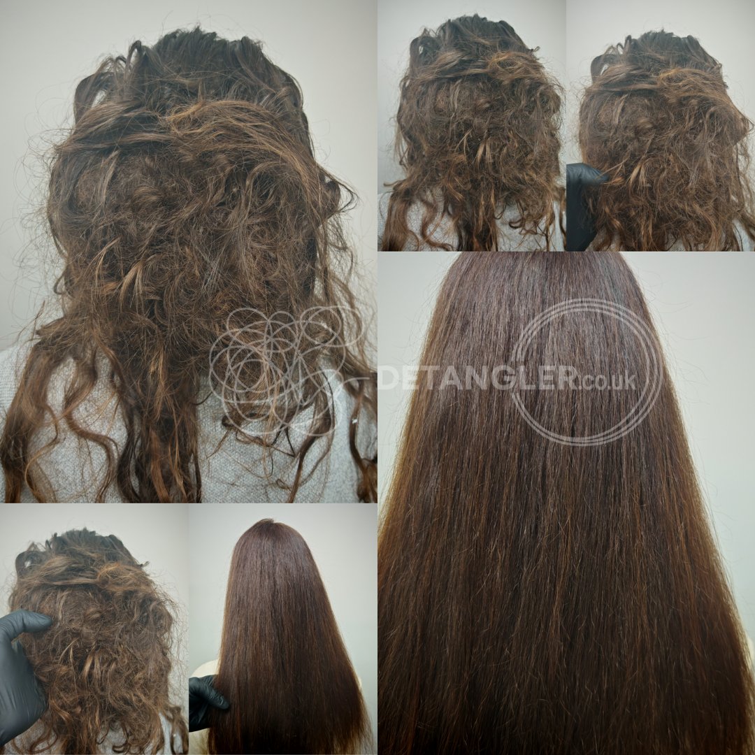 Full head matted hair transformation without scissors — documented case 35
