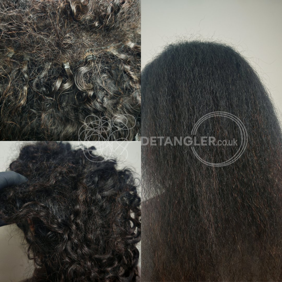 Elderly matted hair restoration — home visit case Detangler London — documented case 36