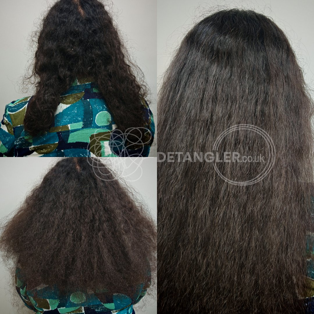Post-chemotherapy matted hair recovery at London studio — documented case 38