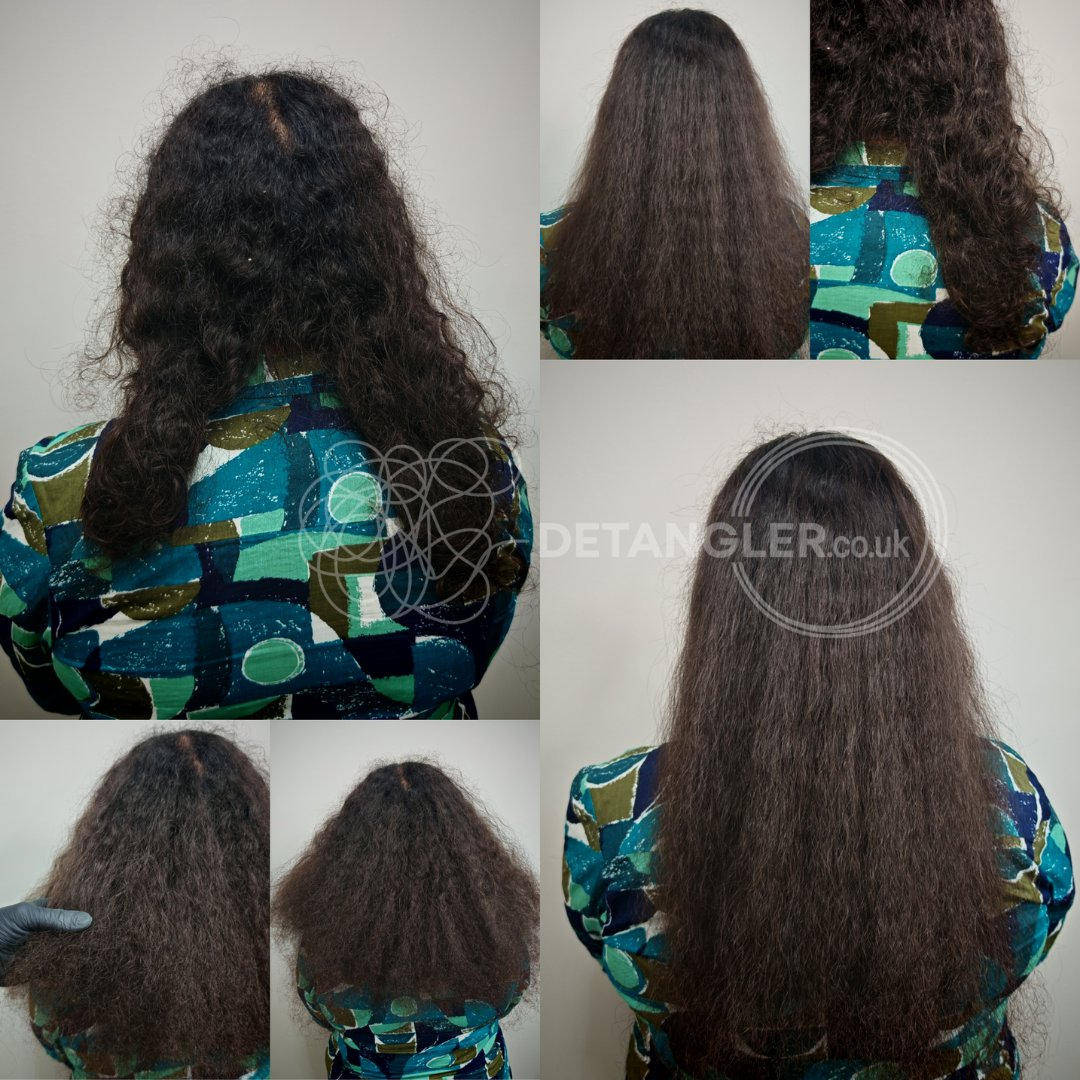 Mid-length matted hair before and after restoration — documented case 39