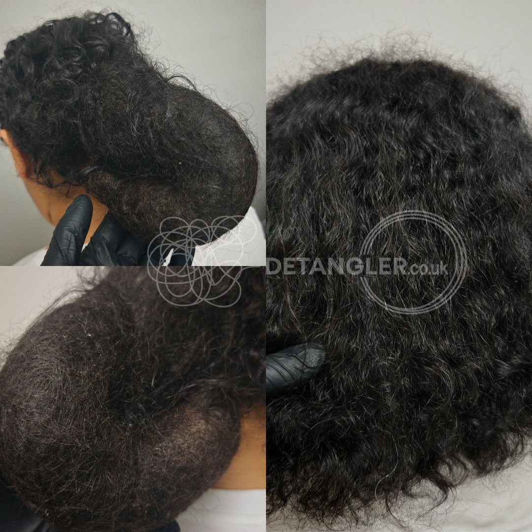 Natural afro matted hair specialist transformation London — documented case 40