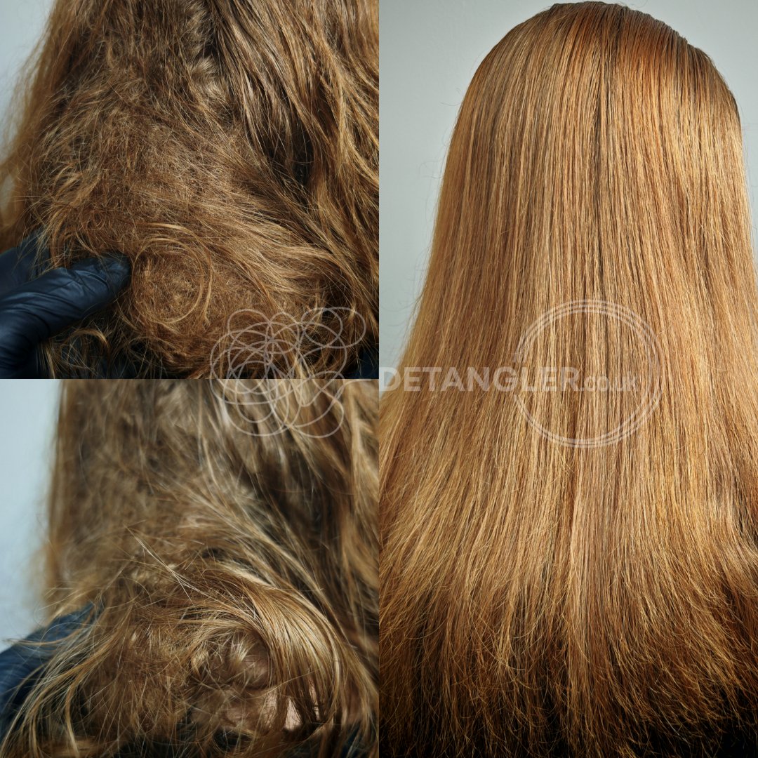 Dense matted hair restored without cutting — Detangler Catford SE6 — documented case 43