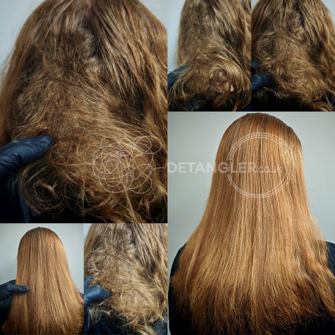 Before and after photo of matted hair recovery at London studio — documented case 44