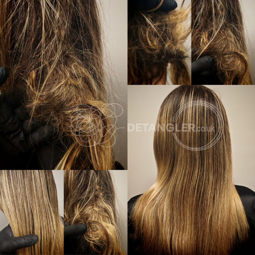 Severe hair matting recovery by professional London specialist — documented case 48