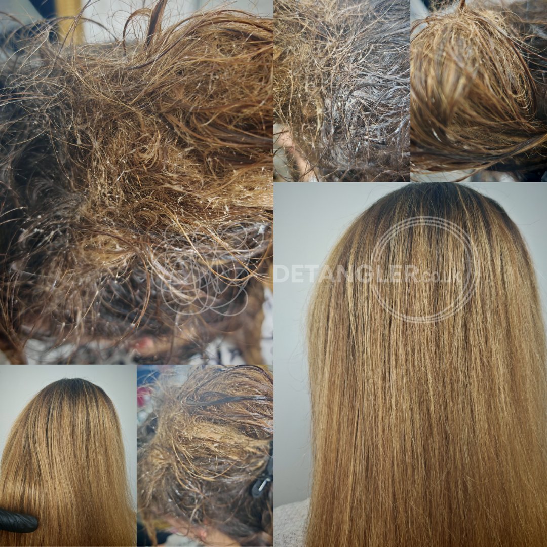Professional matted hair restoration with documented before after photos — documented case 50