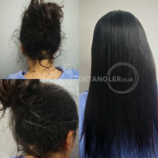 Before and after showing hair length fully preserved through the restoration
