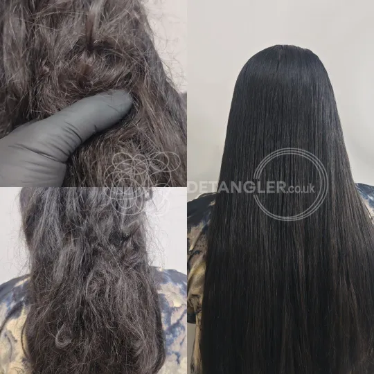 Matted hair restoration documented as part of 1,000+ completed cases