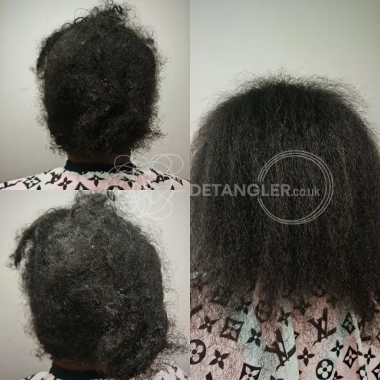 Matted hair restored in a single appointment with no time limit