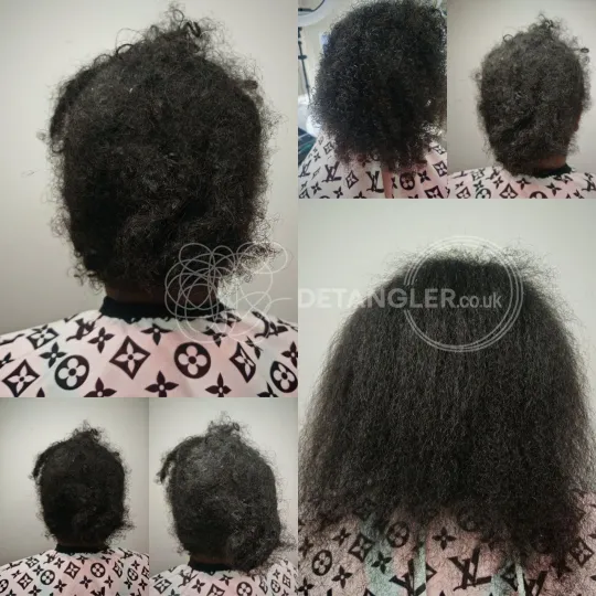 Months of matting removed without cutting, photographed with client consent