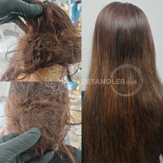 Severely matted hair combed out completely with no cutting at the Matted Hair London studio