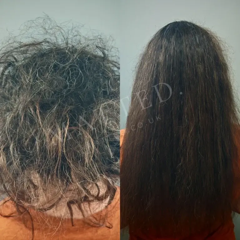 Root to tip matting in straight hair cleared without cutting, documented with client consent