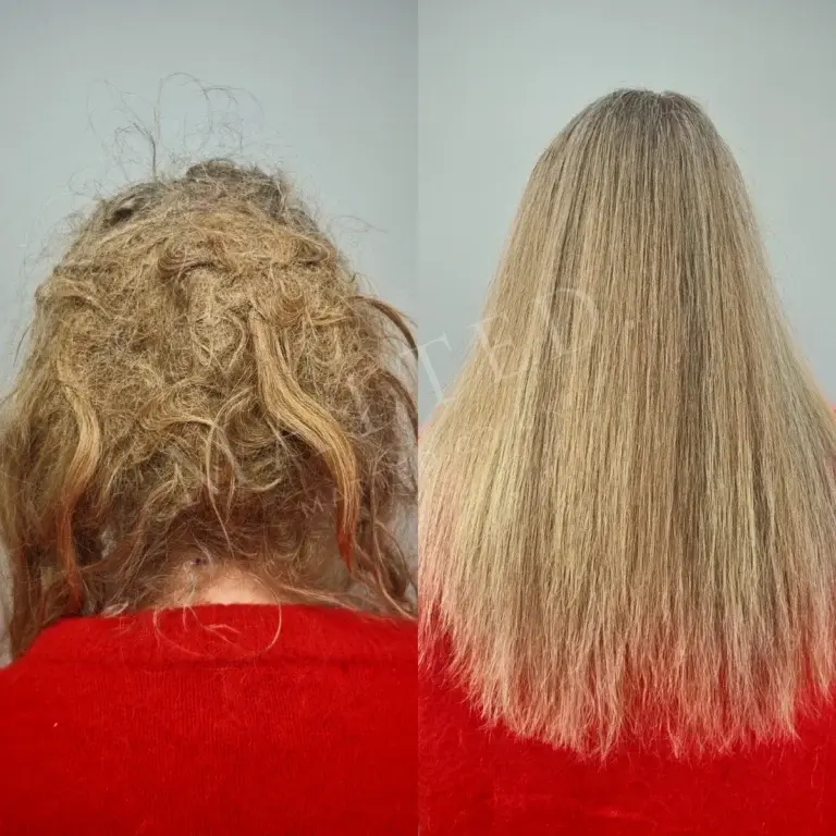 Severely matted straight hair restored in a single session at the studio in Catford, south east London