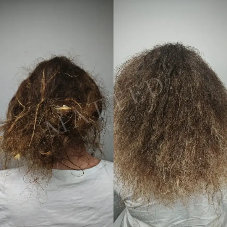 Curly hair matted into clumps, separated without cutting and returned to its own curl pattern