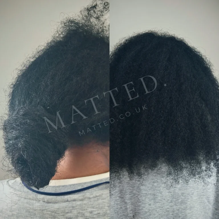 Matted afro-textured hair before and after, opened without cutting and without heat