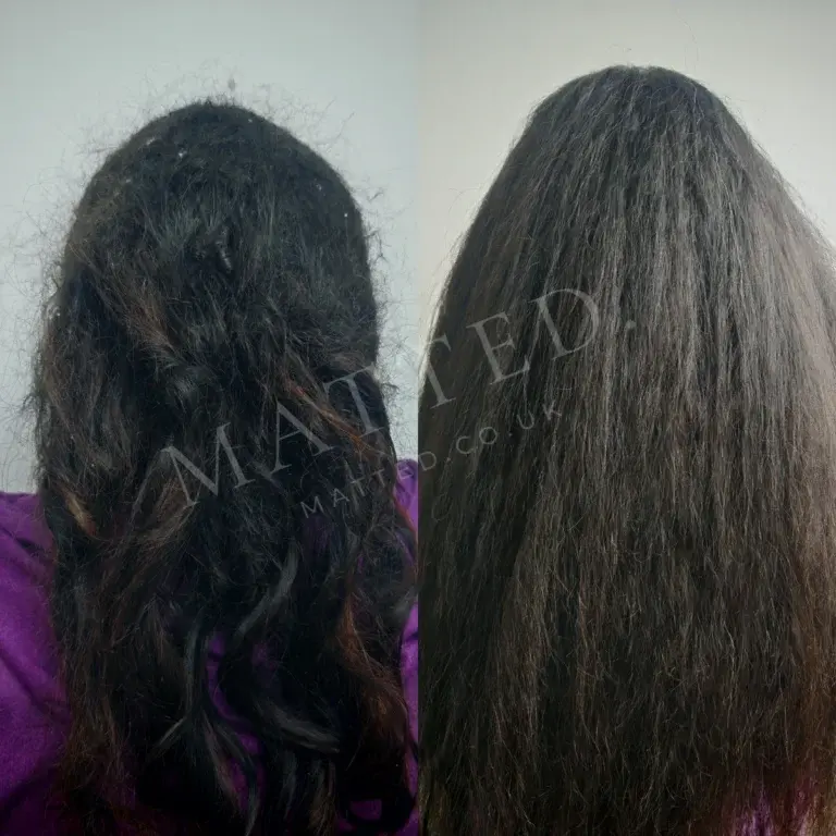 Severely matted straight hair combed out completely, photographed the same day