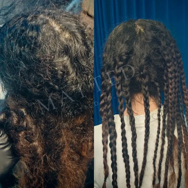 A child's matted wavy hair before and after, opened without cutting