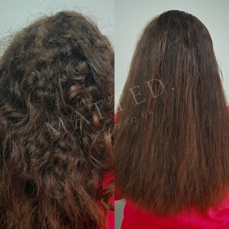 Severely matted straight hair restored with no pressure on the scalp
