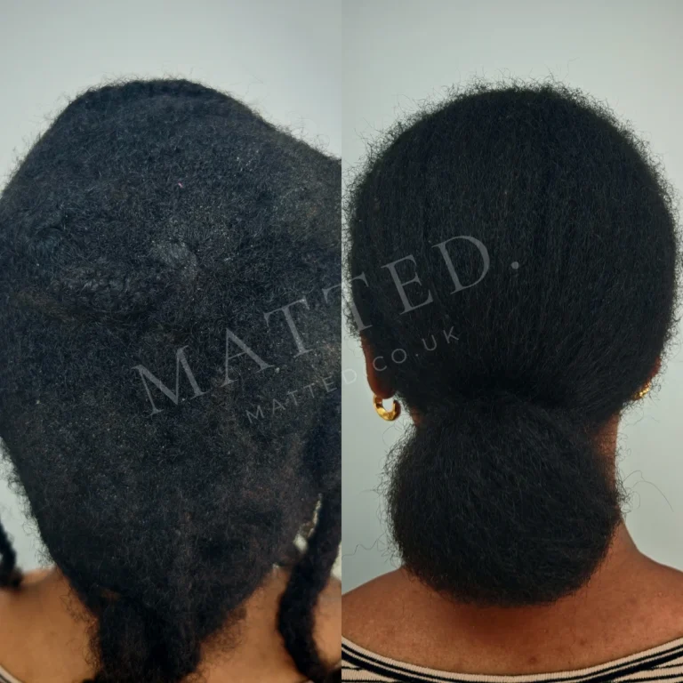 Matted afro-textured curls separated strand by strand and left in their natural pattern