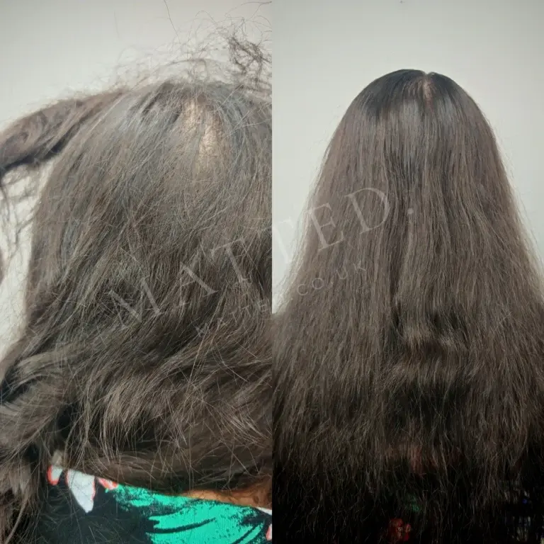 Matting at the back of the head in straight hair, the spot clients cannot see themselves