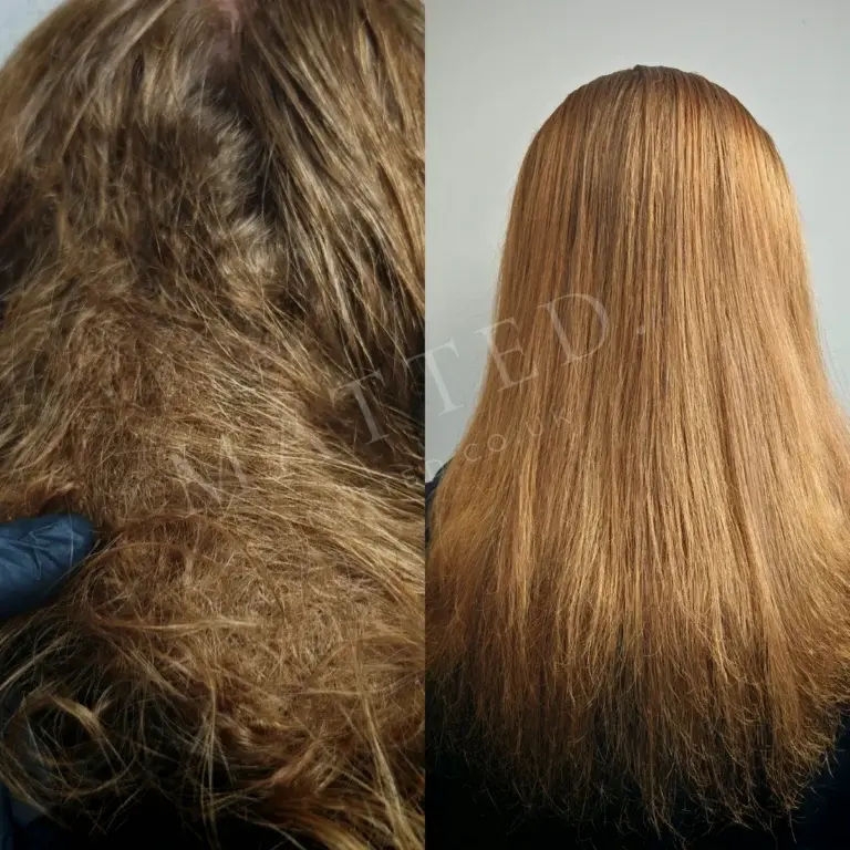Severely matted straight hair before and after treatment in the Catford studio