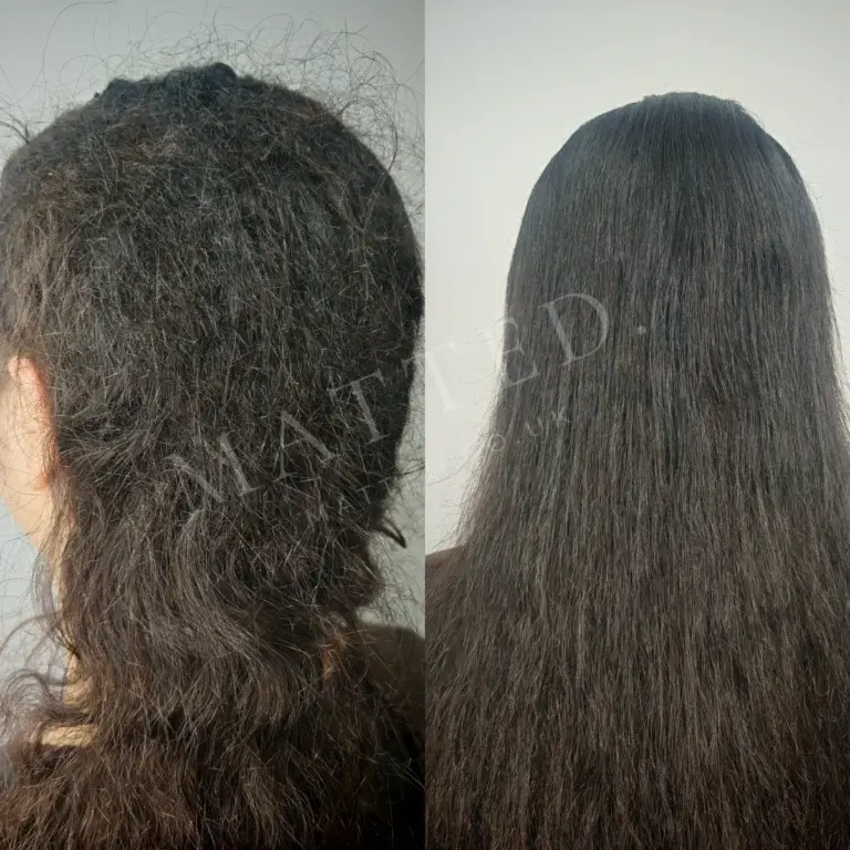 Matted wavy hair from a period of depression, restored without judgement and without cutting