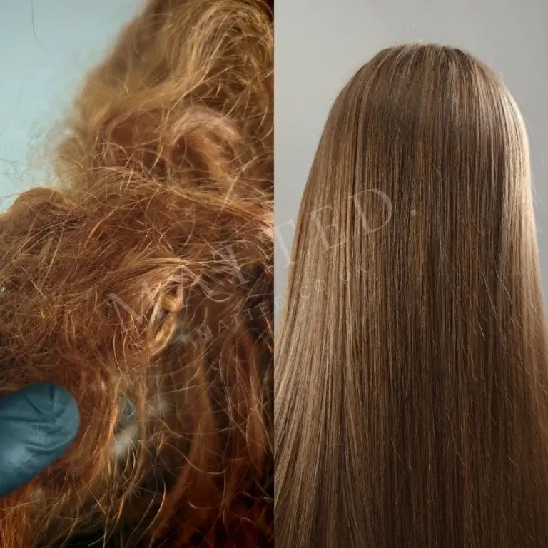 Severely matted straight hair cleared without breaking the hair shaft