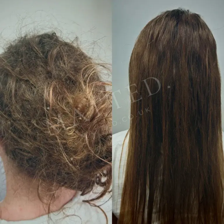 Straight hair matted during a depressive episode, combed clear and kept at full length