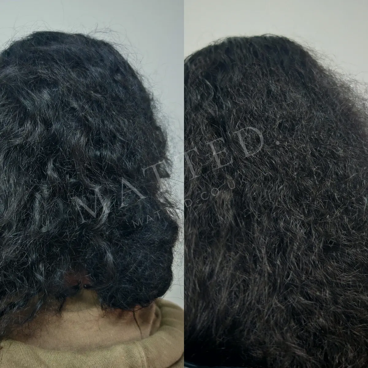 Severely matted wavy hair after a long illness, before and after a bedside restoration