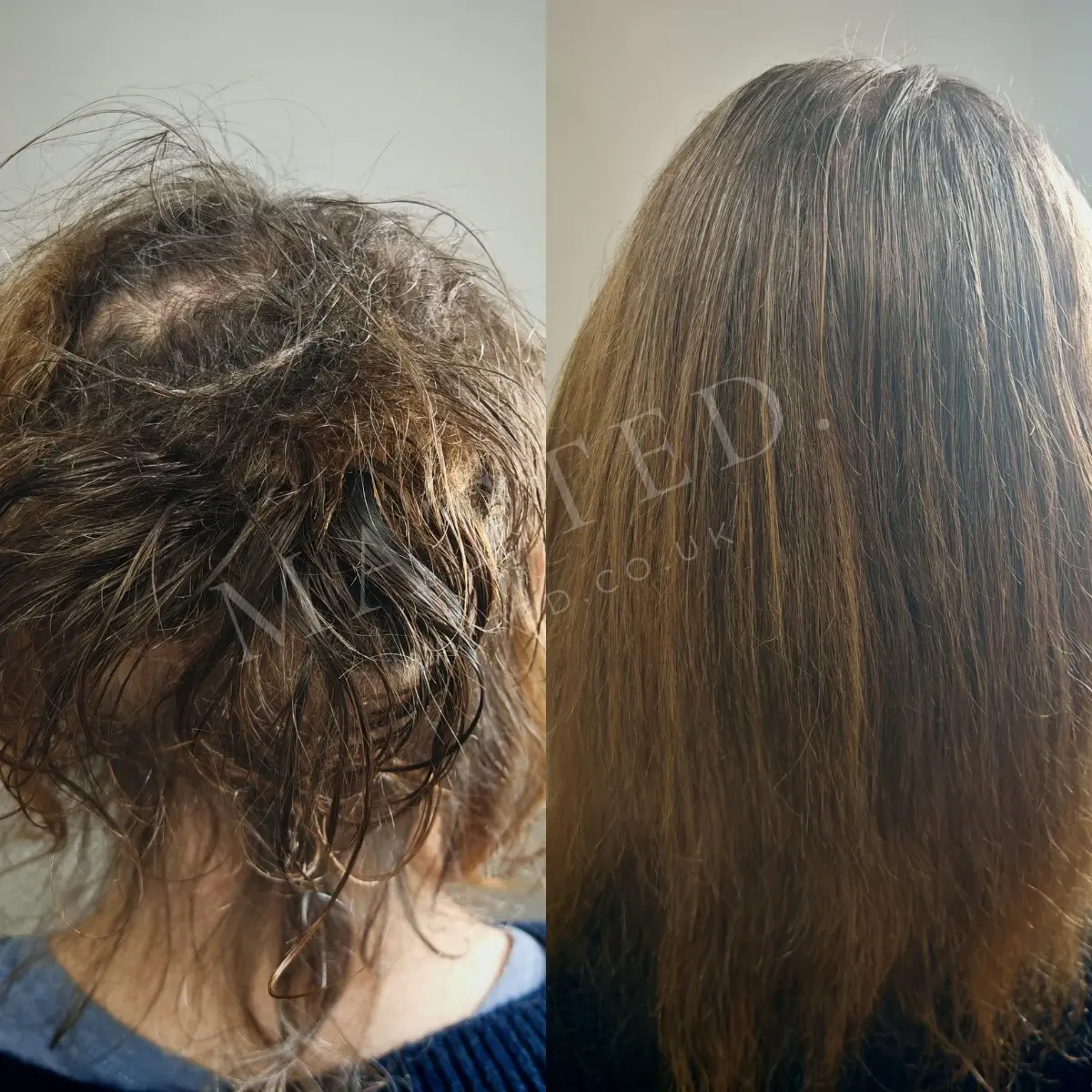 Straight hair matted in elderly care, before restoration and after, opened without cutting