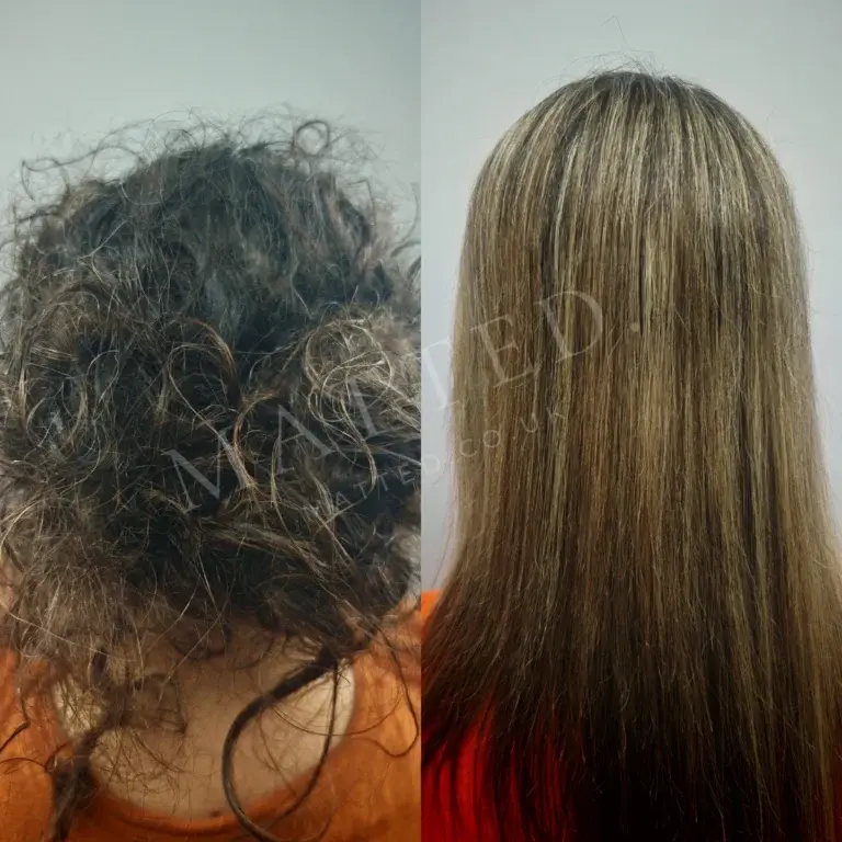 Severely matted straight hair, every knot released rather than cut out