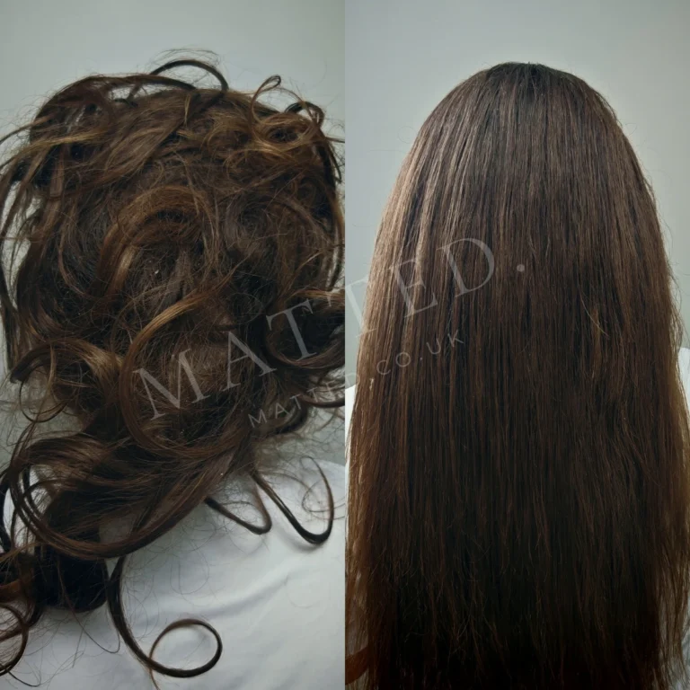 Straight hair matted after a hospital stay, restored without cutting